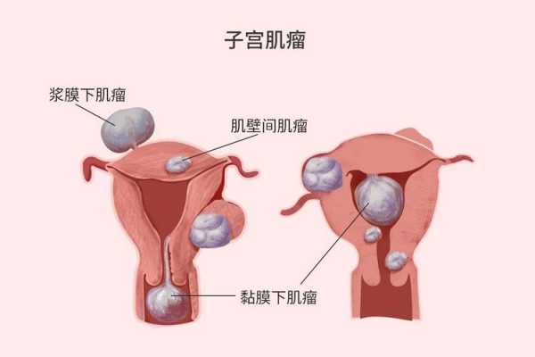 健康子宫照片（健康子宫的表现）-图1