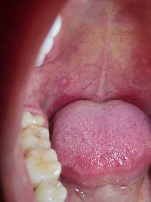 健康的口腔上颚图片（健康的口腔照片）-图2