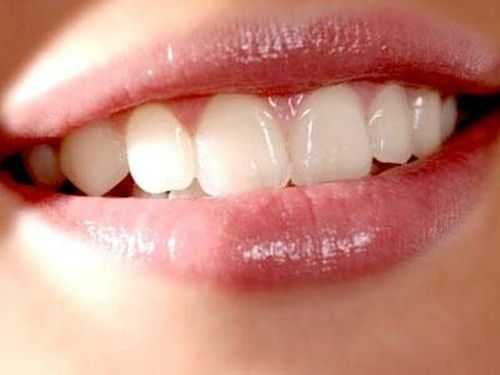 最健康牙齿（健康牙齿的标准颜色）-图1